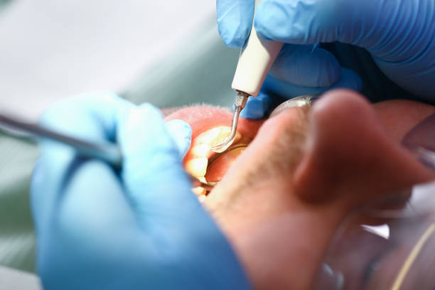 Best Holiday Emergency Dentist in Pinehurst, ID