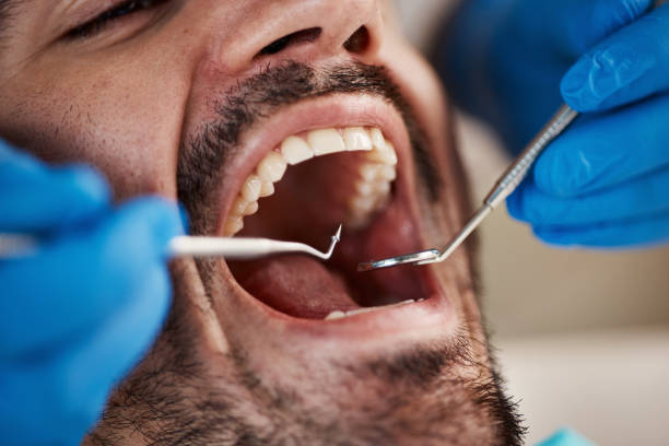 Best Pediatric Emergency Dentist in Pinehurst, ID